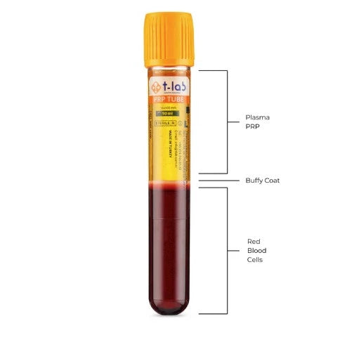 Platelet-Rich Plasma PRP injection for use in regenerative medicine - from T-Lab