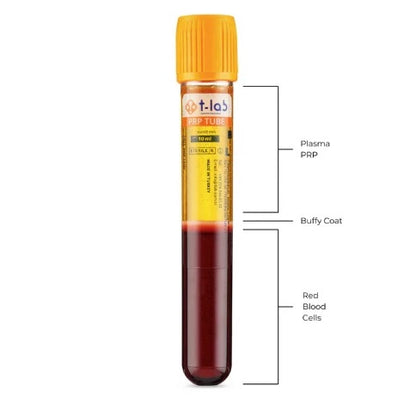 Platelet-Rich Plasma PRP injection for use in regenerative medicine - from T-Lab